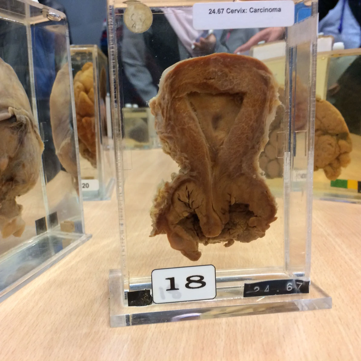 Tumour structure and nomenclature logo