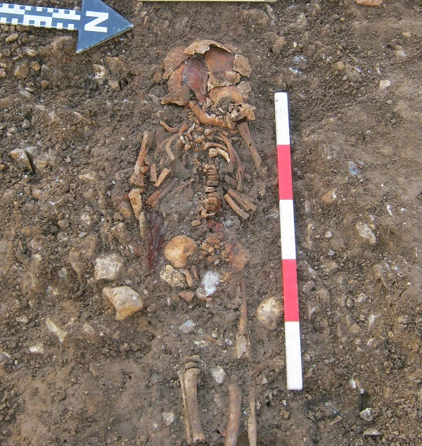 Diagnosing diseases of childhood: a bioarchaeological and palaeopathological perspective logo