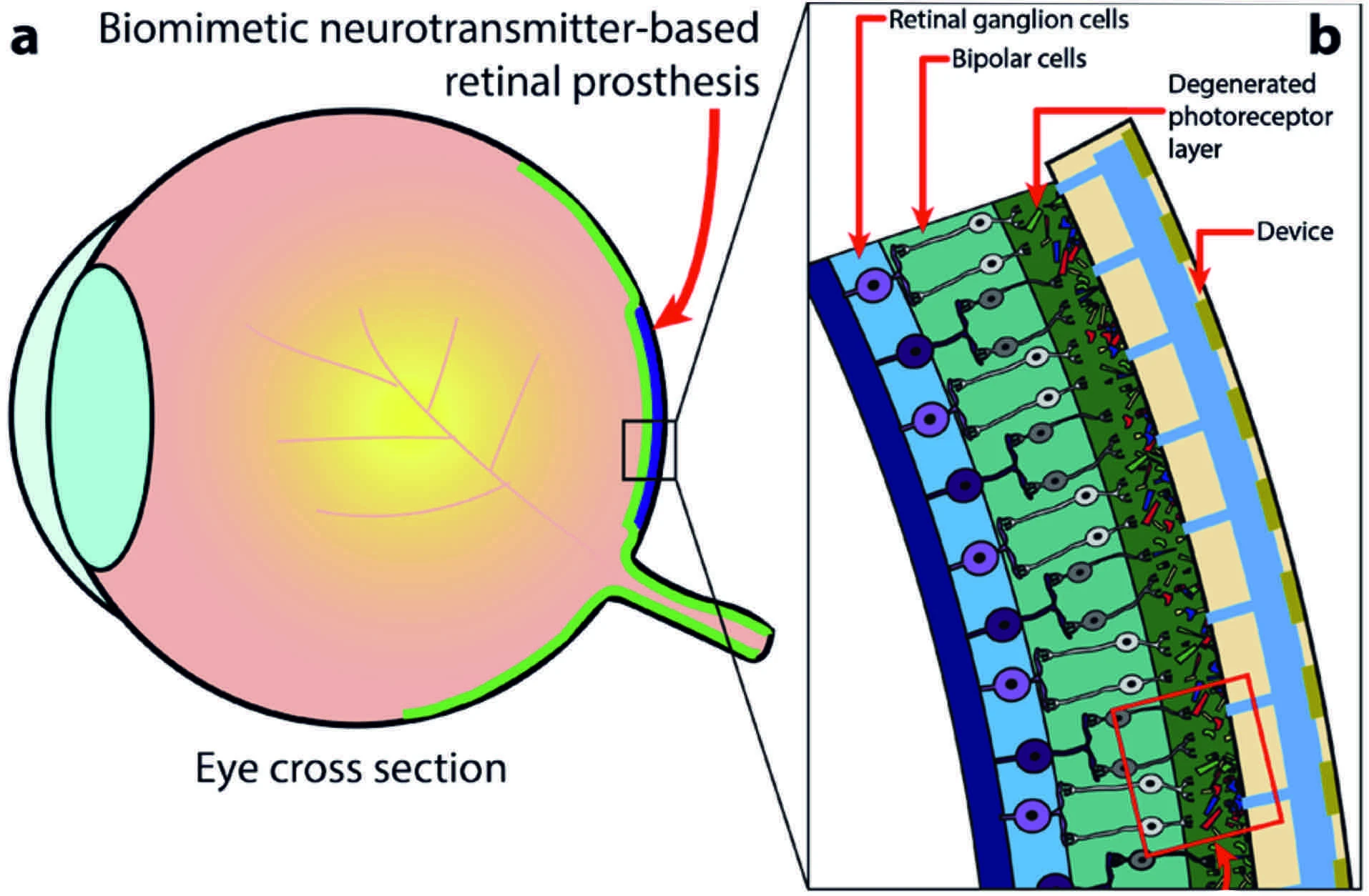 Development of a chemical retinal prosthesis logo