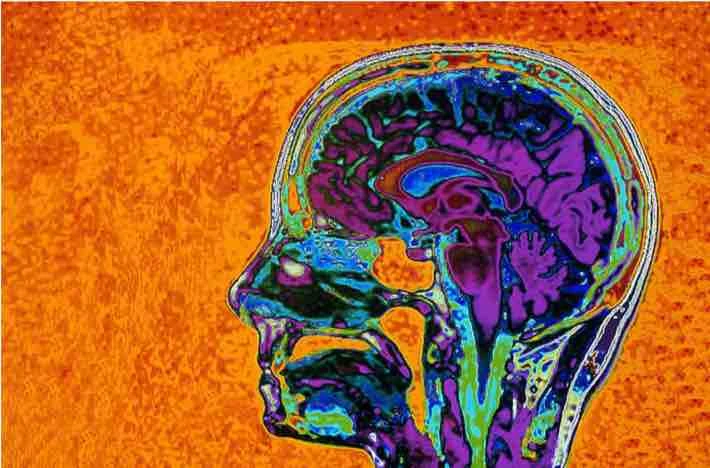 Hearing and seeing things that are not there: Quantifying brain structure related to hallucinations logo