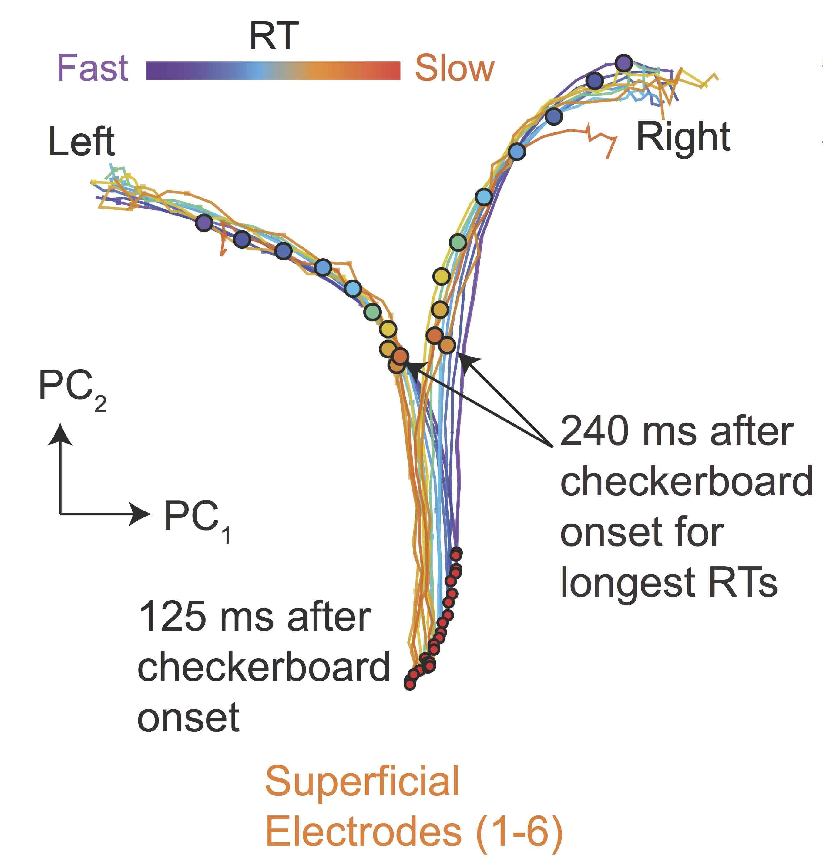 Single Trial Neural Circuit Dynamics Underlying Perceptual Decision-Making logo