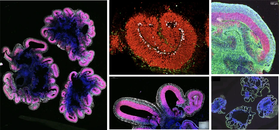 Brain organoids to study development and function logo