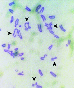 New insights into the Fanconi Anaemia Tumour Suppressor Pathway from Slime mould to Mice logo