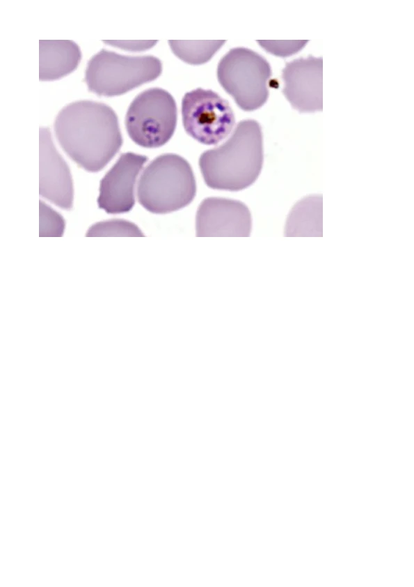 Malaria - algae that kill logo